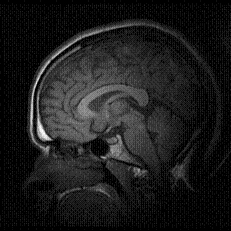 Brain Engineering